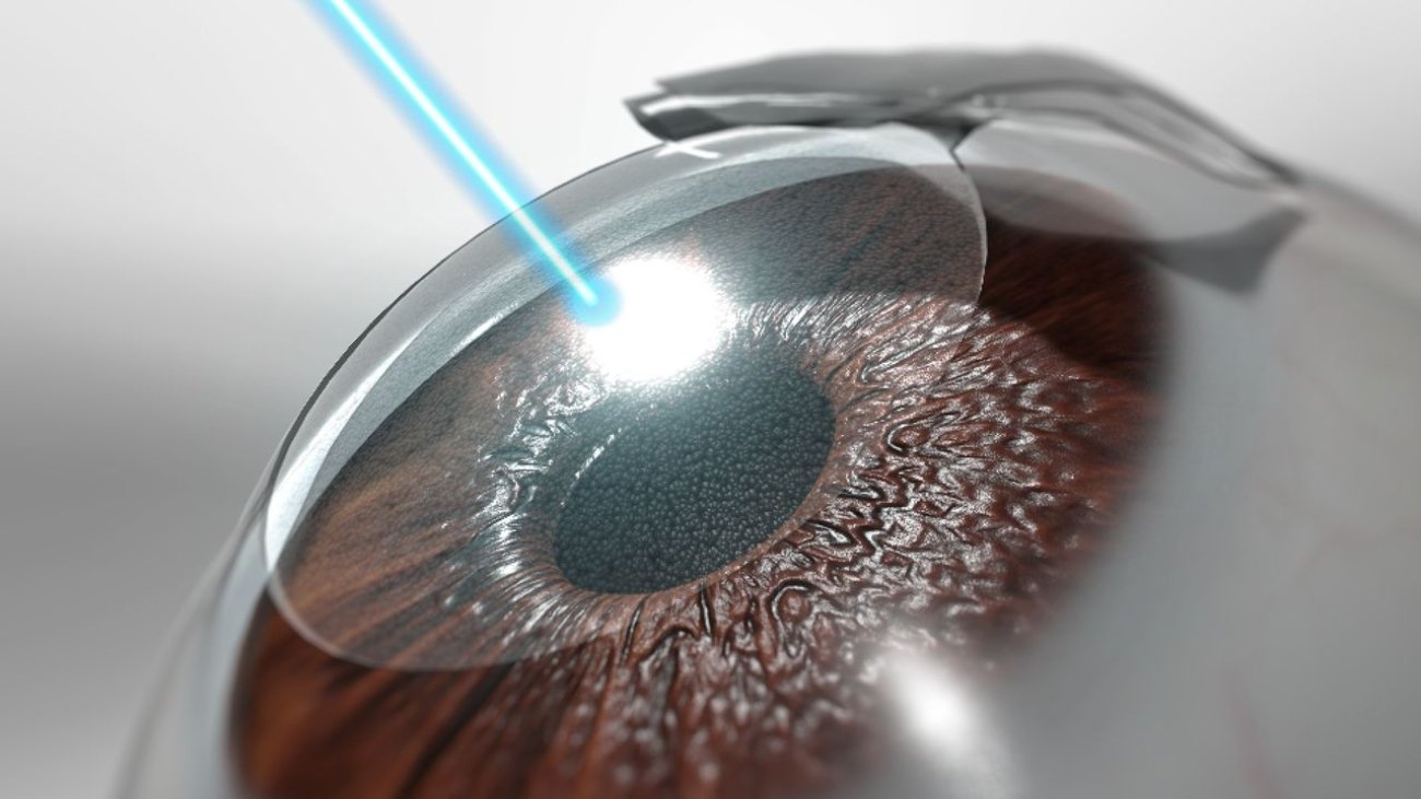 Laser anwendung in der medizinischen Behandlung